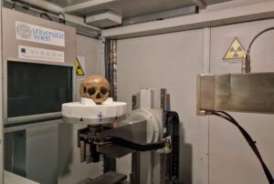 Skull in CT Scanner